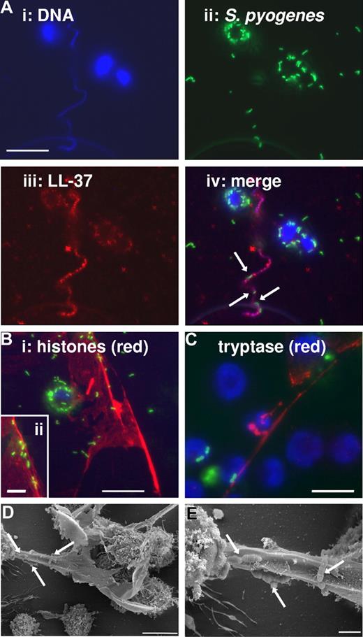 Figure 2. Immunofluorescence and FESEM examination of human MCETs. MCs were seeded on poly-L-lysine–coated glass slides, stimulated with 25 nM PMA for 10 minutes, then infected with FITC-labeled S pyogenes (MOI 25:1) for 1 hour and fixed with 4% paraformaldehyde. (A) Colocalization of DNA, S pyogenes, and LL-37 in MCETs (bars, 10 μm): (i) Dapi-stained DNA; (ii) FITC-labeled S pyogenes; (iii) immunostaining of LL-37 with Alexa-red–labeled antibodies against human LL-37; and (iv) overlay of A1-3. (B) Immunostaining of MCETs with Alexa-red-labeled antibodies against histones (bar, 10 μm). Insert in the lower-left corner (ii) shows a higher magnification of S pyogenes (green) entrapped in the MCETs (red; bar, 3.5 μm). (C) Immunostaining of MCETs with Alexa-red–labeled antibodies against tryptase. S pyogenes are labeled green and DNA are labeled blue (bar, 8 μm). (D) FESEM image of MCETs produced by human MCs during coculture with S pyogenes. Microorganisms entrapped in the MCETs structures are indicated by white arrows (bar, 5 μm). (E) Higher magnification showing S pyogenes entrapped in the fibers of the MCETs (white arrows; bar, 1 μm).