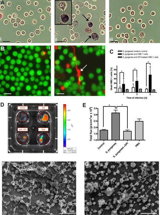 Figure 5. Formation of MCETs is dependent of reactive oxygen species (ROS)-induced MCs death. (A) Production of ROS by S pyogenes–infected MCs in the presence or absence of NADPH oxidase inhibitor DPI. Uninfected MCs (i) or S pyogenes–infected MCs cultured in the absence (ii) or presence of DPI (iii) were incubated with NBT for 45 minutes and examined by light microscopy. Precipitation of formazan indicating active production of ROS is indicated by arrows in panel ii (bars, 10 μm). (B) Immunofluorescence photograph showing viable (green) versus dead (red) MCs of uninfected cells (i) or cells after coculture with S pyogenes (ii). Note the release of DNA by dying MCs (arrow) in panel ii. All bars in panel B represent 10 μm. (C) Quantification of MC death in control medium (□), coculture with S pyogenes (■), or coculture with S pyogenes in the presence of DPI (▩). The data are presented as percentage of PI-stained dead cells determined by flow cytometry. Bars represent the means plus or minus SD of 3 independent experiments. *P < .05 by F-test. (D) Quantification of DNA release by MCs after 1 hour of culture in the presence of PMA or S pyogenes and with or without DPI. The amount of DNA was measured as intensity/total flux of red fluorescence (Sytox orange) using the Xenogen Vivo Vision IVIS 200 System with the filter setting of 532 nm excitation/580 nm emission and Igor Pro 4.09A software. A diagram showing the quantitative data are displayed in panel E. (F) FESEM image of MCETs produced by human MCs after 6 hours of either stimulation with 100 mU/mL of glucose oxidase (F) or with S pyogenes (G). Bar, 50 μm.
