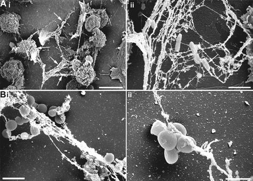 Figure 7. Induction of MCETs by S aureus and P aeruginosa. HMC-1 cells were seeded on poly-L-lysine–coated glass slides, then infected with S aureus or P aeruginosa (MOI 1:25) for 6 hours and fixed with 4% paraformaldehyde and examined by FESEM. (A) P aeruginosa entrapped by MCETs (white arrows; bars are 10 μm for panel Ai and 2 μm for panel Aii). (B) S aureus entrapped by extracellular fibers produced by MCs (bars are 2 μm for panel Bi and 1 μm for panel Bii).