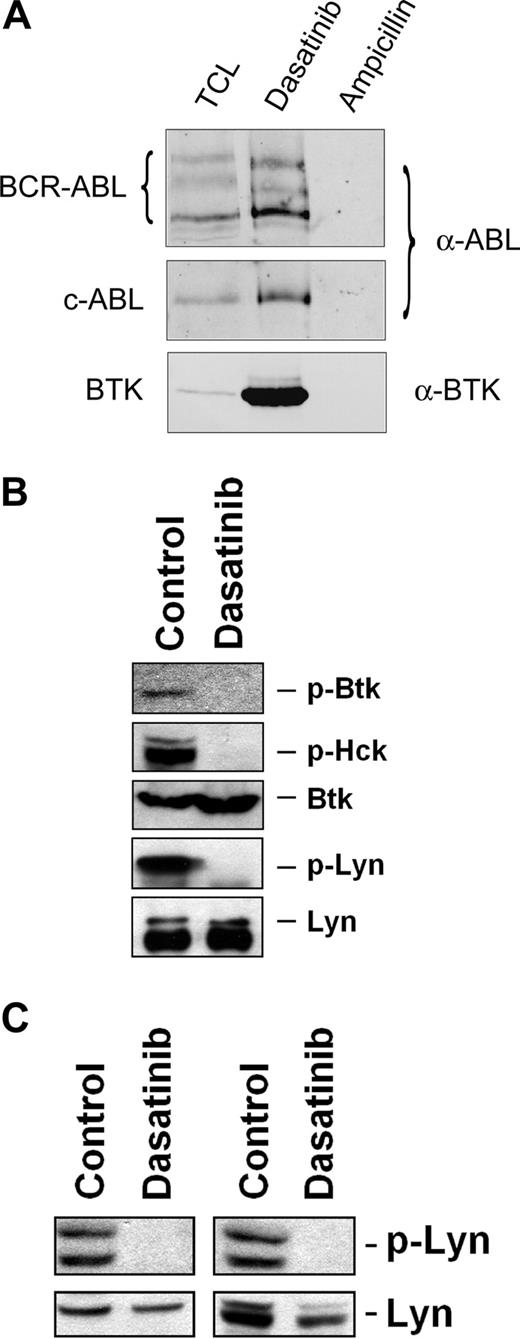 Figure 6. Dasatinib binds to and blocks phosphorylation of Btk in human basophils. (A) Anti-ABL and anti-BTK immunoblots of KU812 pulldowns with dasatinib and ampicillin (negative control). The samples were resolved by sodium dodecyl sulfate–polyacrylamide gel electrophoresis (SDS-PAGE) on a 7% gel. Regions corresponding to BCR-ABL (∼ 210 kDa), c-ABL (∼ 145 kDa), and BTK (∼ 75 kDa) are displayed. TCL indicates total cell lysate (120 μg TCL protein loaded). (B) Immunoblot of lysates derived from KU812 cells after cells had been exposed to control medium or dasatinib (1 μM) at 37°C for 4 hours. Antibodies against phosphorylated Btk (p-Btk), p-Hck, total Btk, and total Lyn were applied as indicated. For detection of p-Lyn, immunoprecipitation was performed using total Lyn antibody and antiphosphotyrosine 4G10 antibody. (C) Basophils obtained from 2 leukemia patients with basophilia (AML, left panel; CML, right panel) were preincubated with control medium or dasatinib (3 μM) at 37°C for 15 minutes, and then were exposed to an anti-IgE antibody (1 μg/mL) at 37°C for 10 minutes. After incubation, cells were recovered and subjected to Western blotting using antibodies against p-Lyn and total Lyn protein. Western blotting was performed as described in the text.