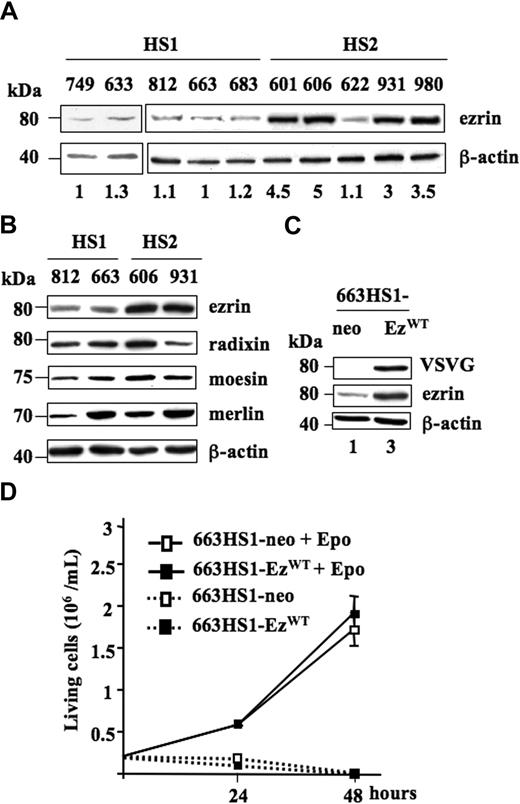 Figure 1. Expression of EzrinWT in HS1 and HS2 spi-1 transgenic proerythroblasts. (A) Whole-cell lysates from HS1 preleukemic cells (749, 633, 812, 663, and 683) and HS2 leukemic cells (601, 606, 622, 931, and 980) were subjected to Western blot analysis using an antibody raised against ezrin. The blot was stripped and reprobed with an anti-actin antibody to visualize the equal loading of proteins. Molecular weight standards are indicated on the left of the panels. The membrane was exposed in an Imager, and the resulting signal was quantified using the ImageGauge software package (Fuji, Paris, France). Values were normalized to actin expression. Basal protein level was AU for 663 HS1 cells. The ezrin expression level for each cell line is indicated. Western blot is from a representative experiment. (B) Ezrin, radixin, moesin, and merlin expression. Whole-cell lysates from HS1 preleukemic cells (812 and 663) and HS2 leukemic cells (606 and 931) were subjected to Western blot analysis using antibodies raised against ezrin, radixin, moesin, merlin, and β-actin as a loading control. (C) Expression of ezrin in whole-cell lysates from one clone of 663 HS1 cells transfected either with pEF-neo or pEF-neo EzrinWT-VSVG constructs and cultured in the presence of Epo. Lysates were analyzed by Western blotting. The membrane was first probed with an anti-VSVG antibody and then with an anti-ezrin antibody. β-actin served as a loading control. Fold-increase in ezrin expression is indicated at the bottom of each lane. (D) Enforced expression of wild-type ezrin did not change the proliferation characteristics of transfected 663 HS1 cells (663H1-EzWT versus 663HS1-neo cells) whether cells were cultured in the presence (1 U/mL) or in the absence of Epo. Numbers of living cells were monitored at 24 and 48 hours using the Trypan blue (0.2% in PBS) exclusion staining (Sigma-Aldrich) and a Vi-Cell analyzer (Beckman Coulter, Villepinte, France). The mean number of living cells and standard deviations were determined from 3 experiments.