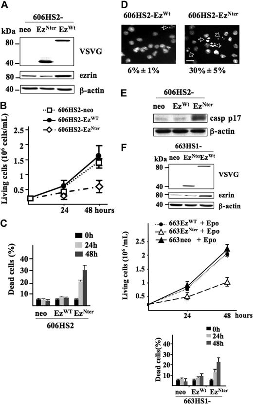 Figure 2. Expression of EzWT and EzNter in HS2 and HS1 proerythroblasts. (A) 606HS2 cells were transfected with either pEF-neo EzWT-VSVG or pEF-neo EzNter-VSVG or pEF-neo empty vector. Whole-cell lysates from 606HS2-EzWT cells, 606HS2-EzNter cells, and 606HS2-neo cells were subjected to Western blotting using anti-VSVG and anti-ezrin antibodies. The membrane was reprobed with an anti–β-actin antibody as a loading control. The apparent molecular weight of endogenous and EzWT-VSVG (80 kDa) and the apparent molecular weight of EzNter-VSVG (40 kDa) are indicated on the left of the panel. Fold-increase in ezrin expression in 606HS2-EzNter and 606HS2-EzWT was calculated in comparison to 606 HS2-neo cells. Notably, because the anti-ezrin antibody is directed against the C terminal region of ezrin, EzNter could not be detected. (B) Proliferation of 606HS2-EzWT, 606HS2-EzNter, and 663HS1-neo cells. Data are means plus or minus SD of 4 independent experiments performed in triplicate. (C) The percentage of dead cells was determined by Trypan blue exclusion assay on 606HS2-EzWT cells, 606HS2-EzNter cells, and 606HS1-neo cells at 24 hours and 48 hours of culture. Data are issued from the experiment presented in panel B. (D) Detection of fragmented and condensed nuclei in apoptotic cells by fluorescence microscopy. Representative images after Hoechst staining of 606HS2-EzWT cells and 606HS2-EzNter cells cultured for 48 hours. Arrows indicate apoptotic bodies. A total of 3 different fields (500 cells per field) were scored by 2 investigators. Percentage of apoptosis is indicated as means plus or minus SD of 3 independent experiments. Bar corresponds to 15 μm. (E) Processing of caspase-3 in 606HS2-EzWT cells, 606HS2-EzNter cells, and 663HS1-neo cells. WCEs were subjected to Western blotting using an anti-cleaved caspase-3 p17. β-actin served as a loading control. (F) 663HS1 cells were transfected with either pEF-neo EzWT-VSVG, pEF-neo EzNter-VSVG, or pEF-neo empty vector. Whole-cell lysates were subjected to Western blot using anti-VSVG and anti-ezrin antibodies. The membrane was reprobed with an anti–β-actin antibody as a loading control. Living 663HS2-EzWT, 663HS2-EzNter, and 663HS1-neo cells were numbered, and percentages of dead cells were determined by Trypan blue exclusion assay at 24 hours and 48 hours of culture. Data are means plus or minus SD of 3 independent experiments performed in triplicate.
