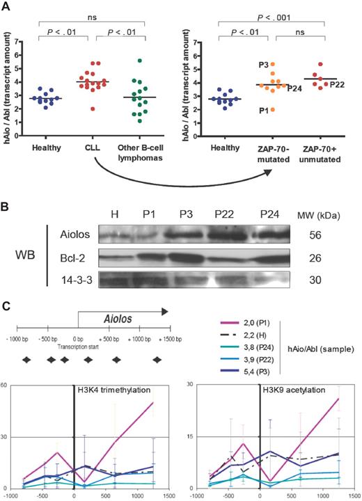 Figure 2. An Aiolos overexpression in CLL patients who seem independent of Aiolos promoter epigenetic modifications. (A) Total amounts of Aiolos transcripts in each subgroup of patients and healthy subjects of the set 2 (Table 2) obtained by reverse-transcribed quantitative polymerase chain reaction of B-cell RNA by the primer pair/probe couple 1 and normalized to the Abelson gene (Abl, Applied Biosystems, Hs00245445_m1). Absolute quantification of Aiolos and Abelson was done using known quantities of pcDNA3.1-hAio1 construct and Daudi total RNA, respectively. Differences between groups were tested using one-way ANOVA and Tukey multiple comparison tests (Prism4.0c software; ns indicates nonsignificant, ie, P > .05). (B) Western blot analysis of Aiolos and Bcl-2 expression in a healthy donor (H) and in the CLL patients P1, P3, P22, and P24. 14-3-3 protein is used as internal control. Molecular weights of the proteins are shown. (C) Schematic representation of the position of the primer pairs used to analyze chromatin remodeling and levels of trimethylated H3K4 (Abcam, Cambridge, MA; AB8580, 1/250) and acetylated H3K9 (Upstate Biotechnology, Charlottesville, VA; 07 352, 1/100) obtained in the CLL patients P1, P3, P22, and P24, and in one healthy donor H. The y-axis corresponds to the percentage of immunoprecipitated chromatin. The x-axis corresponds to the position in the promoter of the chromatin modification. The corresponding Aiolos transcript amounts are shown. Primers sequences were as follows: A1 forward 5′-TGGTCACTTCCCCTTTCCTCT-3′, A1 reverse 5′-TCCCAACACCCTCCCTACTG-3′; A2 forward 5′-CAGTTCCCAGAGGGAAAACAAA-3′, A2 reverse, 5′-TTGGTCCAAGTTTTCAGACAGTTG-3′; A3 forward 5′-GACAAAAAGTTCCAGATCTTCCTCA-3′, A3 reverse 5′-GTCAGCCTTGCTTTCTTGGc-3′; A4 forward 5′-GAGAGGCCGAGTAGCCACAG-3′, A4 reverse 5′-TTGCACAGGTTAAGTTTCTCAAAGA-3′; A5 forward 5′-TTGGCATTTGCAGTTCCCTT-3′, A5 reverse 5′-AACCTGATTTTTTGCGCTGG-3′; A6 forward 5′-TGGGCTGTTGTATACTATGGGAAA-3′, A6 reverse 5′-CGGCTAGGAAAAATAGTGTTGGA-3′.