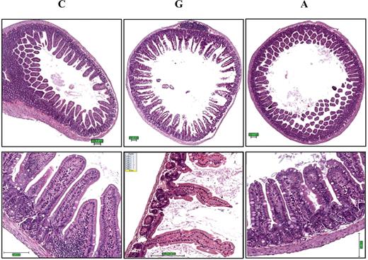 Figure 3. Gossypol has greater gastrointestinal toxicity than apogossypol. Balb/c mice were orally administered apogossypol (A), gossypol (G), or vehicle control (C) at a daily dose of 120 μmol/kg 5 times weekly for 3 weeks (6 mice per group). Representative H&E histology is presented of intestinal tissue (duodenum) of treated mice in cross-section (top) and longitudinal section (bottom). Note denuding of mucosal epithelium in gossypol-treated mice, with shortening and loss of villi. Size bars represent 100 μM.