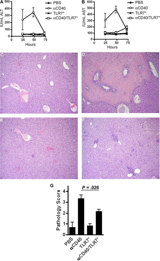 Figure 5. Hepatic toxicity associated with αCD40 monotherapy is reversed with TLR7 agonism. (A,B) Kinetic analysis of serum transaminases. Mice were treated with PBS, 100 μg αCD40, 100 μg TLR7*, or both intravenously. Serum was isolated at various time points afterward, and serum levels of alanine transaminase (A) or aspartate transaminase (B) were measured as described. Data are representative of 3 independent experiments, with n = 3 to 8 mice per group, per time point. (C-F) Histologic analysis of livers treated with PBS (C), 100 μg αCD40 (D), 100 μg TLR7* (E), or 100 μg αCD40 and 100 μg TLR7* (F) for 48 hours. (G) Semiquantitative assessment of histopathologic changes in livers from mice treated as above for 48 hours. Data are pooled from 2 independent experiments, with n = 6 mice in each treatment group. P = .026 by Mann-Whitney nonparametric test.