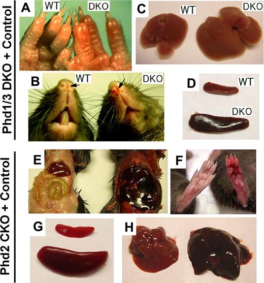 Figure 1. Erythemic appearances in Phd1/3 DKO and Phd2 CKO mice. (A-D) Erythemic external appearance (reddish paw and snout, A and B, respectively), and enlarged liver (C) and spleen (D) in Phd1/3 DKO mice. WT, wild-type; DKO, Phd1/3 double knockout mice. (E-H) Phd2 CKO mice and Phd2f/f control mice. Abdomens (E) and paws (F) at approximately 6 weeks after tamoxifen treatment of both CKO and Phd2f/f mice. Note the necrotic intestine and red paw in Phd2 CKO mice. Left, Phd2f/f; right, Phd2 CKO. (C) Spleens. Top, Phd2f/f; bottom, Phd2 CKO. (D) Livers. Left, Phd2f/f, right, Phd2 CKO. Images were taken with a CoolSNAP charge-coupled device digital camera (Photometrics-Roger Scientific, Tucson, AZ) attached to a Leica MZFLIII stereomicroscope (Leica Microsystems, Heerbrugg, Switzerland). A single objective lens (Leica Plan 1.0, 10× magnification, Leica Microsystems) was used to obtain the images. Openlab (Improvision, Lexington, MA) was used for initial image acquisition, and Photoshop 7.0 (Adobe Systems, San Jose, CA) was used for subsequent processing.