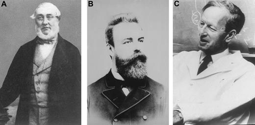 Figure 3. (A) Henry Bence Jones. (B) Otto Kahler (courtesy of Dr Heinz Ludwig, Vienna). (C) Jan Waldenström (courtesy of Giampaolo Merlini, Pavia, Italy).