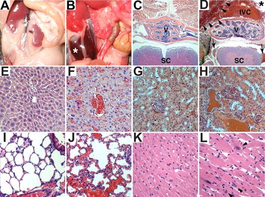 Figure 5. Histologic and cardiac alterations after conditional inactivation of PHD2. (A,B) Gross appearance of abdomen in PHD2+/+;Cre-ER (A) and PHD2 flox/flox;Cre-ER (B) mice treated with tamoxifen at E17.5 and at 3 weeks of age. Note large retroperitoneal hematoma (asterisk) in PHD2 flox/flox;Cre-ER mouse (B). (C-L) Hematoxylin and eosin staining of PHD2+/+;Cre-ER (C,E,G,I,K) and PHD2 flox/flox;Cre-ER (D,F,H,J,L) treated with tamoxifen as in panels A and B. Sections are from spine (C,D), liver (E,F), kidney (G,H), lung (I,J), and heart (K,L). Note large retroperitoneal hematoma (arrowheads), severely dilated inferior vena cava (IVC; see also Figure S3), as well as evidence of hemorrhage in spinal canal (arrows). SC indicates spinal cord; V, vertebral body. *Aorta.