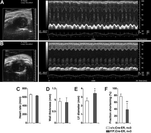Figure 6. In vivo transthoracic echocardiography. Representative echocardiograms of 6 week old PHD2+/+;Cre-ER (A) and PHD2 flox/flox;Cre-ER (B) mice after Tamoxifen treatment as in Figure 4A,B. Short axis views (left panels) show evidence of left ventricular dilatation in PHD2 flox/flox mice. Representative M-mode views (right panels), in which a cross section of the short axis view is monitored over time, shows dilatation as well a depressed left ventricular function. Inactivation of PHD2 did not affect heart rate (C) or wall thickness (D), but increased end diastolic left ventricular diameter (E) and decreased fractional shortening (F). *P < .05; **P < .01. Error bars indicate 1 SD.