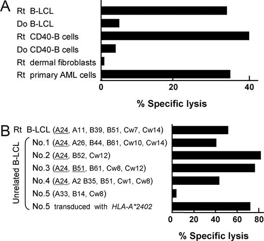 Figure 1. Specificity of CTL-1B9 against hematopoietic cells and its restriction HLA. (A) The cytolytic activity of CTL-1B9 was evaluated in a standard 4-hour 51Cr release assay (E/T ratio, 20:1). Targets used were B-LCL, CD40-activated (CD40-B) B cells, dermal fibroblasts, and primary acute myeloid leukemia cells from the recipient (Rt), and B-LCL and CD40-B cells from his donor (Do). Rt dermal fibroblasts were pretreated with 500 U/mL IFN-γ and 10 ng/mL TNF-α for 48 hours before 51Cr labeling. (B) Cytolytic activity of CTL-1B9 against a panel of B-LCLs derived from unrelated individuals, each of whom shared 1 or 2 class I MHC allele(s) with the recipient from whom the CTL-1B9 was generated. The shared HLA allele(s) with the recipient are underlined. B-LCLs (no. 5) which did not share any HLA alleles with the recipient, were retrovirally transduced with HLA-A*2402 cDNA and included to confirm HLA-A*2402 restriction by CTL-1B9. Results are typical of 2 experiments and data are the mean plus or minus the standard deviation (SD) of triplicates.