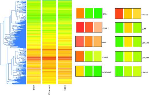 Figure 1. Unsupervised clustering of genome-wide expression profiles of PCNSL and non-CNS nodal and extranodal DLBCL. The gene list used was approximately 11 500 in number (genes present on at least 35 of the 43 arrays). The metric used was “standard correlation” in GeneSpring. Because the 2-color array method involved a reference standard, the colors do not represent actual gene expression levels in the tumor samples but rather the ratio of the tumor mRNA to the reference mRNA. The LOWESS method of normalization was used. To the right of the cluster are shown 10 genes of interest enlarged from the cluster; the colored bars correspond to the 3 phenotypes identified at the bottom of the cluster (“Brain,” “Extranodal,” and “Nodal”; left to right). SPP1 (osteopontin), CHI3L1 (chitinase-3 like 1), IRF4 (MUM1), S-100B (S-100 calcium binding protein beta), SERPINA3 (serine proteinase inhibitor, clade A, member 3), CRYAB (crystallin alpha B), LUM (lumican), COL1A2 (collagen type 1 alpha 2), COL6A1 (collagen type 6 alpha 1), and LAMA4 (laminin alpha 4).