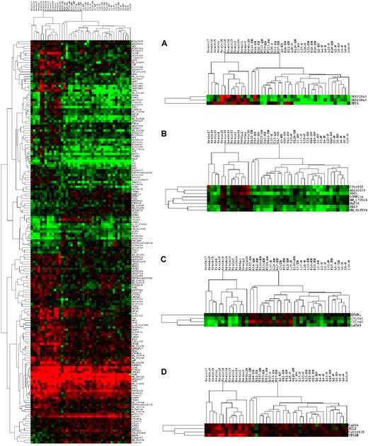 Figure 4. Clustering results using FDA genes separating 2 classes: CNS versus non-CNS. The left-hand plot shows the complete tree, whereas 4 regions within the tree are shown at right. Shades of red indicate ratios more than 1.0; shades of green indicate ratios less than 1.0; black indicates a ratio of 1.0.