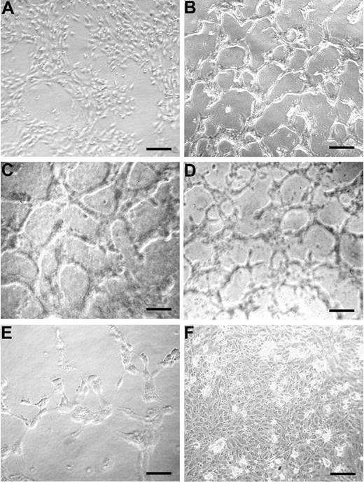 Figure 5. Peptide 12 sustains vessel formation in vitro. HUVECs were incubated on 24-well plates precoated with a type I collagen gel mixture, in the absence (A) or presence of peptide 12 (B), peptide Q225A (D), or peptide Y220A (E). VEGF-A was used as a reference control (C). To assess the specificity of peptide 12 activity, an antibody against peptide 12 was also tested in combination with peptide 12 (F). Results are representative of 3 independent experiments. Bars represent 25 μm in C, 50 μm in the others.