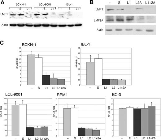 Figure 1. Inhibition of endogenous LMP1 and LMP2A by siRNA results in depletion of constitutive NF-κB activity in EBV+ cells. (A) The indicated cell lines were transfected with a LMP1 siRNA (L1), and scrambled siRNA (s), and compared with mock-transfected cells (−). (B) IBL-1 cells were transfected with an LMP1 siRNA (L1), LMP2A siRNA (L2A), or both, and scrambled siRNA (s), and compared with mock-transfected cells (−). In panels A and B, protein extracts were prepared 48 hours after transfection and probed with antibodies to LMP1 or LMP2A, as indicated. Actin reprobing was performed to assure even protein loading. (C) BCKN-1, IBL-1, LCL-9001, RPMI-8402, and BC-3 cells were transfected with a NF-κB luciferase reporter plasmid, and either scrambled siRNA as a control (S), or siRNA for LMP1 (L1), LMP2A (L2A), or both. Luciferase assays were performed 48 hours after transfection. Values shown are averages (+ SEM) of 1 of 2 independent experiments in which each transfection was performed in triplicate, and are shown as relative luciferase units (RLU), which represent a ratio of NF-κB firefly luciferase to constitutive renilla luciferase. Baseline values correspond to those seen in mock-transfected cells and vary for each cell line.