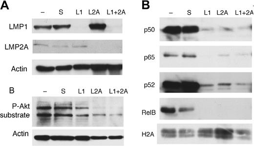 Figure 3. LMP2A affects activation of Akt and nuclear translocation of Rel proteins in IBL-1 cells. (A) The IBL-1 lymphoma cell line was transfected with siRNA to LMP1 (L1), LMP2A (L2A), or both (L1 + 2A), as well as scrambled (S) as indicated, or mock transfected (−). Proteins were extracted 48 hours after transfection, and probed with antibodies to LMP1 or LMP2A, confirming suppression of the corresponding protein. Actin reprobing was performed to ensure even protein loading. (B) Extracts as in panel A were evaluated for activation of Akt by immunoblotting with an antibody to phospho-Akt substrates, showing that knockdown of LMP2A affects this pathway more significantly than knockdown of LMP1. (C) Nuclear extracts were prepared from cells 48 hours after transfection as in panel A, and probed for the Rel proteins is indicated. Suppression of both LMP1 and LMP2A resulted in significant decrease of nuclear p65 and p50, as well as RelB and p52, showing down-regulation of both the classical and alternative NF-κB pathways. Reprobing with antibodies to histone H2A was performed to confirm similar amounts of nuclear proteins.