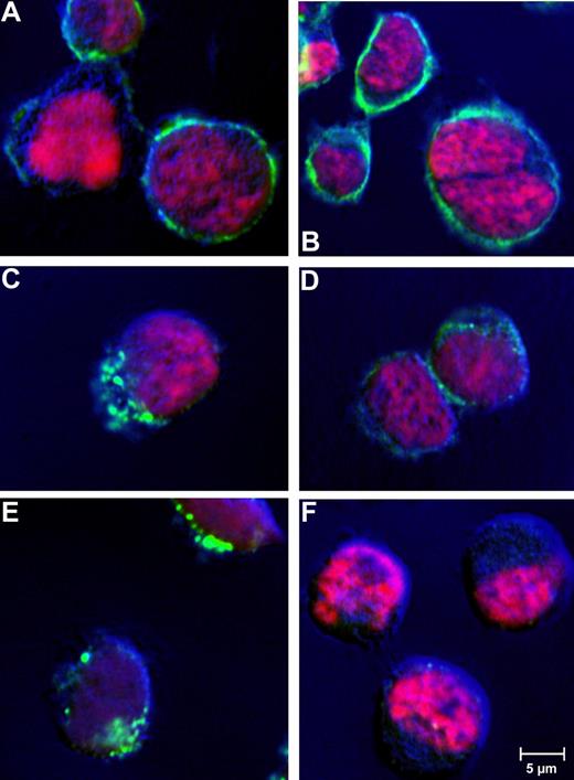 Figure 5. Receptor-mediated internalization of huTR by CD30+ lymphoma cells. Receptor mediated internalization was analyzed by confocal laser-scanning microscopy. CD30+ Karpas 299 (A-E) or CD30− HD-MY-Z cells (F) were incubated with 25 μg/mL huTR (A,C,E,F) or anti-CD30 IgG (B,D) for 4 hours at 4°C (A,B) or 37°C (C-F). Goat anti-human IgG (Fc-specific) antibody FITC conjugate was used for detection (green). Cell nuclei were counter stained with DAPI (channel is shown in pink as false color). Laser-scanning microscopy was performed using a CLSM-510META with a Plan Neofluar 40×/1.3 oil DIC objective (Zeiss). The Argon laser 488-nm line was used for excitation of FITC and the UV laser with 364 nm was used for excitation of DAPI (beam splitter for UV/488 nm). Emitted light of FITC and DAPI was detected using the band pass filters 505 to 550 nm and 385 to 470 nm, respectively.