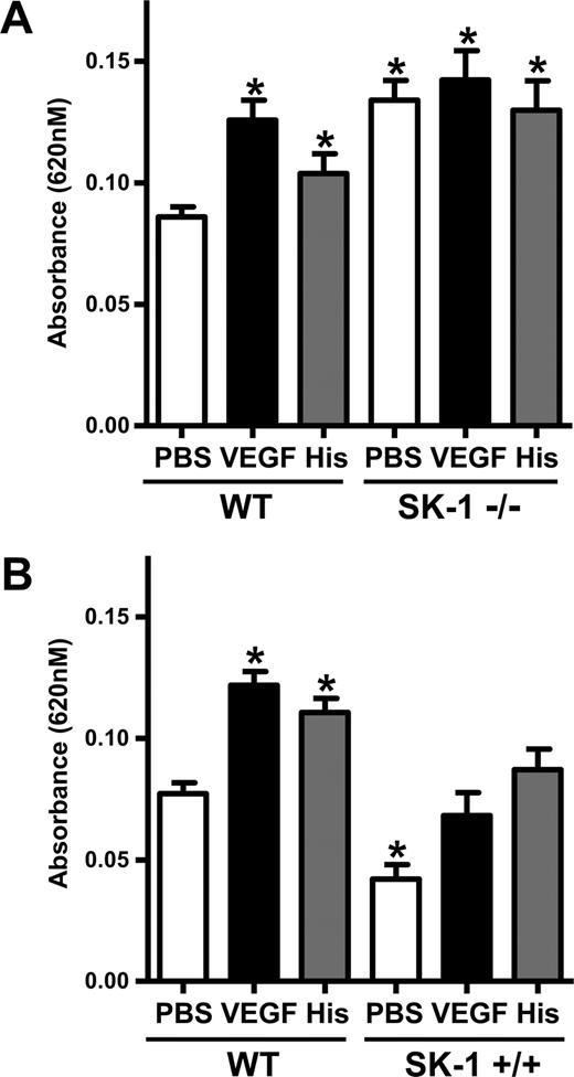 Figure 4. SK-1 regulates EC permeability and vascular leakage in vivo. (A) The absorbances of the dye eluted from the injected areas (PBS, VEGF, and histamine) of 10 age- and sex-matched WT mice and 10 SK-1 KO mice (SK-1−/−) were read at 620 nm. The pooled results (mean ± SEM) for each group of mice are shown (*P < .05 vs WT mice injected with PBS). (B) The absorbances of the dye eluted from the injected areas of 8 age- and sex-matched WT mice and 8 SK-1 transgenic mice (SK-1+/+) were read at 620 nm. The pooled results (mean ± SEM) for each group of mice are shown (*P < .05 vs the WT mice injected with PBS).