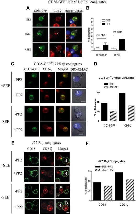 Figure 4. Defective TCR-induced CD38 clustering at the immunologic synapse in a Lck-deficient T-cell line. (A) JCaM1.6 T cells were transiently transfected with the CD38-GFP construct and allowed to conjugate with CMAC-labeled Raji cells pulsed or not pulsed with SEE. Then, cells were fixed, permeabilized, and stained for CD3-ζ (red) as described in Figure 1. Cells were examined using an Olympus Cell R IX81 motorized system inverted microscope (100×/1.3 NA oil objective). CD38-GFP (green), CD3-ζ (red), and the green fluorescence merged with red fluorescence images superimposed on blue fluorescence images from CMAC-loaded Raji cells are shown. The white arrowheads point to the intracellular CD38-GFP or CD3-ζ. The arrows point to the plasma membrane CD38-GFP or CD3-ζ. (B) Comparative analysis of the percentage of conjugates with CD38-GFP or endogenous CD3-ζ redistributed at the contact zone relative to the total number of CD38-GFP+ JCaM 1.6/Raji cell conjugates in the absence (□) or presence (■) of SEE. The data represent the mean plus SEM of 3 independent experiments. In each experiment, 50 to 70 conjugates were analyzed. (C) Jurkat J77 T cells transiently transfected with the CD38-GFP construct, untreated or treated with PP2 (10 μM), were stimulated with CMAC-labeled Raji B cells pulsed or not pulsed with SEE, stained with anti–CD3-ζ (red), and analyzed as in panel A. (D) Comparative analysis of the percentage of conjugates with CD38-GFP or endogenous CD3-ζ redistributed at the contact zone relative to the total number of CD38-GFP+ J77/SEE-pulsed Raji conjugates in the absence (■) or presence of PP2 (▨). In each experiment, more than 40 conjugates were analyzed. (E) Jurkat J77 T cells treated or untreated with PP2 (10 μM) were stimulated with CMAC-labeled Raji B cells pulsed or not pulsed with SEE, stained with anti-CD38 (green) and anti-CD3-ζ (red), and analyzed by a Leica TCS-SP5 confocal scanning laser microscope (63×/1.4 NA oil objective); scale bar equals 4 μm. In this panel, intact cells were incubated with the anti-CD38 mAb HB136 followed by an Alexa Fluor 488–goat anti-mouse IgG, saturated with mouse serum. CD3-ζ was detected by permeabilizing cells (0.5% Triton X-100) prior staining with the anti–CD3-ζ 488 rabbit antibody, followed by the incubation with a Rhodamine Red X–labeled goat anti-rabbit IgG (H + L) highly cross-adsorbed. (F) Comparative analysis of the percentage of conjugates with endogenous CD38 or CD3-ζ redistributed at the contact zone relative to the total number of J77/SEE-pulsed Raji cell conjugates in the absence (■) or presence of PP2 (▨). Data representative of 2 independent experiments. In each experiment, more than 100 conjugates were analyzed.