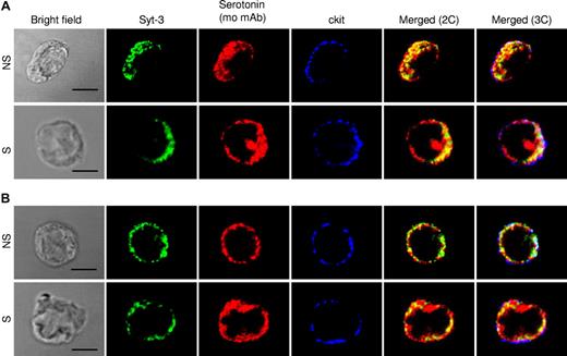 Figure 6. Localization of syntaxin-3, serotonin, and c-kit in resting and stimulated WT and VAMP-8–deficient BMMCs. Colocalization of SG marker syntaxin-3 and serotonin was analyzed in nonstimulated (NS) and PMA/ionomycin (3 minutes)–stimulated (S) WT (A) and VAMP-8–deficient (B) BMMCs. Cells were stained with rabbit anti–syntaxin-3 and mouse antiserotonin. For comparison, relative localization to the plasma membrane marker c-kit (rat mAb) is shown. Cells were analyzed by confocal microscopy. Representative single optical sections as well as 2-color (2C) and 3-color (3C) overlay images are shown. Compartments showing overlap for 2 colors and 3 colors appear as yellow and white, respectively. Bars represent 5 μm.