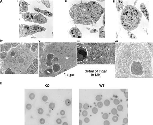 Figure 1. Megakaryocytes (MKs) and platelets from SG−/− mice. (A) Electron micrographs of SG−/− platelets and megakaryocytes. (i) Two average-size platelets with scroll-like membranes called “cigars,” elongated intracellular membranous structures decorated with glycogen particles. (ii) Large hypogranulated platelet and small platelet with cigars. (iii) Large heavily granulated platelet with cigar. No cigars were seen in normal platelets. (iv) Immature MKs with neutrophil. (v) Mature MKs with several neutrophils. “Cigar” is just to left of *. (vi) Detail showing “cigar” from panel v; neutrophil is the one directly left of * in panel v. (vii) Neutrophil surrounded by demarcation membrane system in mature MKs. α-Granules had nucleoids, but many granules were elongated (Figure 1A center; Figure 1C platelet on right). Magnification (at microscope objective): Platelets: (i) ×4200; (ii) ×5500; (iii) ×4200. MKs: (iv,v) ×1000; (vii) ×1600. Additional image information available in “Morphology.” (B) Wright-Giemsa–stained blood smear. Photographs were taken electronically and are presented in their original form. Magnification was ×1000. Note identical appearance of red blood cells in the WT and KO smears.