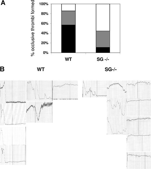 Figure 5. Thrombus formation in the carotid artery after FeCl3 treatment. Experiments were carried out as described in the text. (A) The histogram shows the distribution of responses to FeCl3 treatment. Black indicates stable thrombi; gray, unstable thrombi; and white, no thrombi. (B) Tracings for all mice tested using 2-minute 15-second exposure to FeCl3 are shown. Similar results were found for mice exposed to FeCl3 for 2 minutes 30 seconds. Normal flow rate is approximately 1 mL/min. A flow rate of 0 indicates complete occlusion of the artery by the thrombus.