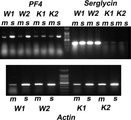 Figure 7. mRNA expression of PF4, serglycin, and actin in bone marrow and spleen of WT and SG−/− cells. mRNA was extracted from bone marrow (m) and spleen (s) of 2 WT (W1 and W2) and 2 KO (K1 and K2) mice. The gel shows the RT-PCR products. Top panel: mRNA for PF4 and SG; marker is the 100-bp ladder. Bottom panel: actin mRNA.