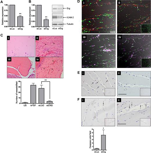 Figure 5. Inhibition of angiogenesis in vivo by Erg siRNA. (A) HUVECs (105) grown on gelatin-coated 6-well plates were transfected with either control siRNA or Erg-specific siRNA (30 nM) for 48 hours. Erg mRNA levels were quantified using RT-PCR, normalized to GAPDH. Erg mRNA expression was significantly reduced after Erg-siRNA treatment, **P < .01. Values are means plus or minus SEM, n = 3. (B) Whole-cell protein extracts were analyzed by SDS-PAGE immunoblotting with antibodies to Erg and tubulin. Erg protein expression was significantly reduced in the Erg-siRNA treated cells, **P < .01. Values are means plus or minus SEM, n = 3. ICAM-2 protein expression was also down-regulated in Erg-siRNA–treated HUVECs, as determined by SDS-PAGE immunoblotting using antibodies to ICAM-2. (C) Matrigel mixture containing siRNA (2 μM) with or without bFGF (80 ng/mL) was injected subcutaneously into C57BL/6 mice. Matrigel plugs were harvested 7 days after implantation, fixed, sectioned, and H&E stained. (i) Matrigel plug without bFGF. (ii) Matrigel plug plus bFGF. (iii) Matrigel plug with bFGF plus Erg siRNA. (iv) Matrigel plug with bFGF plus luciferase control siRNA. Neovessels containing red blood cells (arrows). Original magnification was 10 ×/0.25 Plan objective lens (Olympus). Vessel density was quantified by counting the number of structures containing a lumen and red blood cells. ** indicates P less than .01. Values are means plus or minus SEM, n = 5. (D) Sections from Matrigel plugs treated with siRNA for luciferase (i,iii) or Erg (ii,iv) were stained with antibodies to CD34 (i,ii) or CD45 (iii,iv) and visualized by immunofluorescence confocal microscopy, overlaid with a transmitted light DIC image to enable the vascular structure of the plug to be observed. For CD34 (red), staining is most intense among endothelial cells lining the neovessels (arrows). The pan-leukocyte CD45 antibody (purple) stains isolated cells of the inflammatory infiltrate within the Matrigel matrix and leukocytes inside the lumen of the neovessels (arrows); however. CD45+ cells are also found lining the neovessels, as previously reported.34 Cell nuclei were counterstained with Sytox Green. Inset: IgG-negative controls. Objective lens used was Plan Neofluar 20×/0.5 (Carl Zeiss). Scale bar represents 50 μm. (E) Immunohistochemistry staining with an anti-Erg Ab in the Matrigel plug sections. (i) Endothelial cells lining neovessels express Erg in Luc-siRNA–treated plugs (arrows). (ii) Plugs treated with Erg siRNA show reduced Erg staining. Insert: Control IgG. Original magnification 20×/0.4 Plan N objective lens (Olympus). Scale bar represents 50 μm. (F) (i) Rare apoptotic cells, as shown by anti-Active caspase 3 staining (arrow), are found in Luc-siRNA–treated Matrigel plug samples. (ii) Active Caspase 3–positive ECs are found in Erg siRNA-treated Matrigel plug samples and appear detached from the vessel wall (arrows). *P < .05. Values are means plus or minus SEM n = 3 Erg and n = 5 control. Scale bar represents 50 μm.