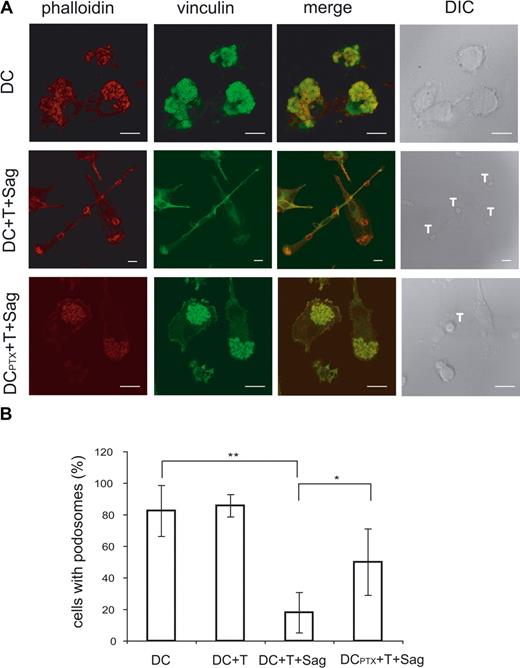 Figure 6. Ag-specific interactions between CD4+ T cells and DCs induce podosome dissolution in DC. (A) Untreated or PTX-treated DCs were cocultured with CD4+T cells on coverslips in the presence or absence of TSST1. Cells were then fixed and labeled with antivinculin Ab (green) and phalloidin (red). Bar, 10 μm. (B) DC-presenting podosomes were quantified, plotted to the total number of cells present in the field, and presented as percentages. Means plus or minus SD of 4 independent experiments are shown; at least 25 total cells were examined for each condition in each experiment. Significance was assessed by Student unpaired t test (*P < .05; **P < .005).