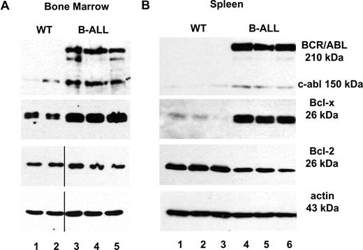 Figure 1. Expression levels of Bcl-xL protein in mice suffering from B-ALL. Protein lysates from (A) bone marrow (wild-type, lanes 1 and 2; B-ALL, lanes 3-5) and (B) spleen (wild-type, lanes 1-3; B-ALL mice, 4-6) from B-ALL mice were compared with wild-type littermate controls after immunoblotting with Bcl-x–, Bcl-2–, and actin-specific antibodies. Expression of p210 BCR/ABL was detected with an antibody against c-abl that also recognizes the fusion protein. Vertical bars indicate repositioned lanes.