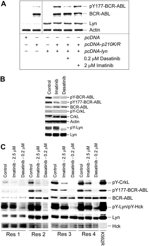 Figure 2. Lyn regulates BCR-ABL tyrosine phosphorylation in CML cells. (A) Cos-7 cells were transfected with a kinase-inactive mutant of BCR-ABL (K271R) or cotransfected with kinase-active Lyn. After 24 hours, cotransfectants were treated with the indicated concentration of kinase inhibitor for 2 hours. Cell lysates were prepared and immunoblotted for site-specific (Y177) BCR-ABL phosphorylation, BCR-ABL, Lyn, and actin levels. Low-level Y177-BCR-ABL was detected in BCR-ABL (K271R)–transfected Cos-7 cells (lane 2) that were not affected by imatinib or dasatinib. The vertical cut line between lanes 2 and 3 denotes merging of the original image to eliminate experimentally irrelevant sample lanes. (B) A leukopheresis specimen from a CML lymphoid blast crisis patient who progressed on imatinib therapy was left untreated (control) or was treated with imatinib (5 μM) or dasatinib (0.25 μM) for 2 hours. Equal protein cell lysates were prepared, resolved by SDS-PAGE, and immunoblotted for the antigen described. For detection of tyrosine-phosphorylated Lyn, 1 mg protein lysate from control or treated cells was subjected to Lyn immunoprecipitation and phosphotyrosine immunoblotting (pY-Lyn). The blot was stripped and reblotted for Lyn (bottom). (C) Specimens from 4 imatinib-resistant myeloid blast crisis patients (Res1-Res 4) that retained wild-type BCR-ABL expression were treated with imatinib or dasatinib (at the concentration indicated) for 2 hours. Equal protein cell lysates were subjected to immunoblotting for phospho-specific and total protein levels (as indicated). K562R cell lysate was used as a positive control for Lyn and other phosphoproteins.