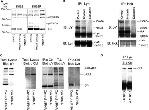 Figure 4. Lyn is associated with c-Cbl and regulates its stability in CML cells. (A) K562 and K562R cells were subjected to electroporation with control or Lyn-specific siRNA, and after 48 hours changes in phosphotyrosine levels were accessed in equal protein lysates by immunoblotting. Migration of molecular mass standards is shown on the left, and individual targets are shown on the right. In addition to a reduction in pY-Lyn levels in Lyn siRNA-treated cells, Lyn down-regulation in K562R cells was associated with differential regulation of 2 phosphoproteins of 75 kDa and 130 kDa. (B) Lyn and Hck were found to be highly expressed in a lymphoid blast crisis CML patient who failed imatinib therapy (Figure 2B). A specimen was obtained and treated with imatinib (5 μM) or dasatinib (0.5 μM) for 2 hours before lysates (1 mg) were prepared and subjected to Lyn (left) or Hck (right) immunoprecipitation. Immune complexes were resolved by SDS-PAGE and immunoblotted for phosphotyrosine. In addition to recovery of Lyn or Hck by immunoprecipitation, 2 phosphotyrosine protein bands (130 kDa, 75 kDa) were detected in control untreated cells. Imatinib-reduced phosphorylation or recovery of the 130-kDa protein in either Lyn or Hck immunoprecipitates, while dasatinib reduced phosphorylation or recovery of both the 130-kDa and 75-kDa phosphoproteins. In a parallel experiment, the Lyn coprecipitating 130-kDa band was excised from a silver-stained gel, subjected to trypsinization, and liquid chromatography/mass spectrometry (LC/MS) analysis. The 130-kDa protein was identified as c-Cbl. The 75-kDa protein has not yet been identified. (C) To confirm c-Cbl as a Lyn-associated and -regulated protein, K562R cells were subjected to Lyn silencing and (first panel) total lysates were immunoblotted for phosphotyrosine, (second panel) total lysates were immunoblotted for c-Cbl, (third panel) c-Cbl immunoprecipitates or total lysate (TL) was immunoblotted for phosphotyrosine, and (fourth panel) total lysates were subjected to c-Cbl immunoprecipitation and Lyn immunoblotting. The migration of specific target proteins is shown on the right. (D) Lyn was immunoprecipitated from protein lysates (250 mg) derived from 2 CML myeloid blast crisis patient specimens and immunoblotted for c-Cbl.