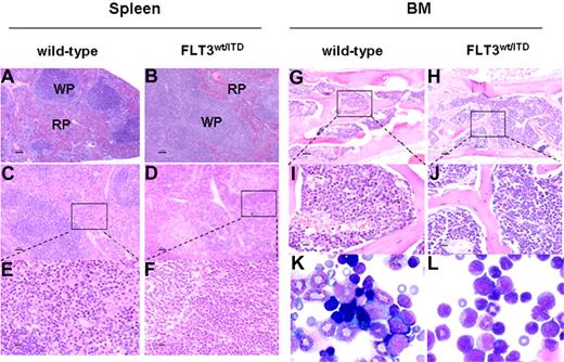 Figure 3. Spleen and BM from FLT3wt/ITD display MPD. (A-F) Spleen sections from 2-month-old wild-type (A) and FLT3wt/ITD (B) mice and from 12-month-old wild-type (C,E) and FLT3wt/ITD (D,F) mice. (G-J) BM sections from 12-month-old wild-type (G,I) and FLT3wt/ITD mice (H,J). (K,L) Cytospins of BM from 12-month-old wild-type (K) and FLT3wt/ITD (L) mice. (A-J) H&E stain. (K,L) Wright & Giemsa stain. Scale bars: 100 μm (A,B); 50 μm (C,D,G,H); and 10 μm (E,F,I,J). Image acquisition: Images A-J were acquired at room temperature using a Zeiss Axioskop upright microscope system (Zeiss, Thornwood, NY) with Achroplan 5×/0.16 NA, 10×/0.3 NA, and 40×/0.6 NA objectives. The images were photographed with an AxioCam camera (Zeiss) and Axiovision 4.0 software (Zeiss). Images K and L were acquired at room temperature using a Nikon Eclipse E600 microscope system (Nikon, Tokyo, Japan) with a Nikon 100×/0.90 NA oil objective (magnification: ×1000) and were photographed with a Nikon DMX 1200 digital camera with ACT-1 2.0 software (Nikon).