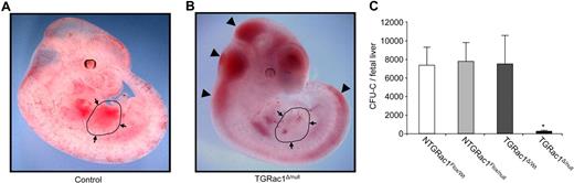 Figure 2. Phenotypic analysis of embryos at E11.5. (A,B) Gross appearance of surviving TGRac1Flox/null embryos and littermate controls at E11.5. The limbs from the right side of the embryos were removed for clarity of presentation. The appearance of the littermate controls was similar for NTGRac1Flox/Wt, NTGRac1Flox/null, and TGRac1Flox/Wt (hereafter referred to as “control”). The anatomic region of the fetal liver is delineated and noted by arrows. The arrowheads point to accumulation of blood in cephalic regions as well as areas underlying the spinal cord, a phenotype previously noted in mutant animals deficient in hematopoietic cell production at the fetal liver stage. (C) Quantitative analysis of fetal liver hematopoiesis as analyzed by CFU/FL of F2 embryos at E11.5. Data represent mean (± SD) of at least 3 embryos analyzed for each genotype. *P < .01, TGRac1Flox/null versus all other genotypes.