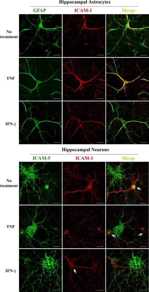 Figure 2. ICAM-1 and ICAM-5 are expressed in hippocampal astrocytes and neurons, respectively. ICAM-1 was immunostained together with GFAP (top panels) or ICAM-5 (bottom panels) in hippocampal cells, and visualized with a confocal fluorescence microscope. ICAM-1 (red) was exclusively expressed in hippocampal astrocytes as indicated by the astrocyte marker GFAP (green, top panels). Coexpression is shown in yellow. ICAM-1 was not detected in hippocampal neurons (bottom panels), whereas ICAM-5 (green, bottom panels) was exclusively expressed in hippocampal neurons, but not in astrocytes (arrows in bottom panels). Bars represent 10 μm.