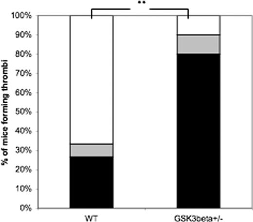 Figure 7. Occlusive thrombus formation following ferric chloride arterial injury. Ferric chloride was applied to the surface of the carotid artery of pentobarbital-sedated mice. Arterial flow rates were measured for 30 minutes with a Doppler flow probe (flow rates for each mouse are shown in Figure S1). Mice were scored as having stable occlusive thrombi (■), unstable occlusive thrombi (▒), or no thrombi (□). The number of mice forming occlusive thrombi differs between WT and GSK3β+/− mice (**P = .01, Fisher exact probability test). The results of 15 WT mice and 10 GSK3β mice are shown.
