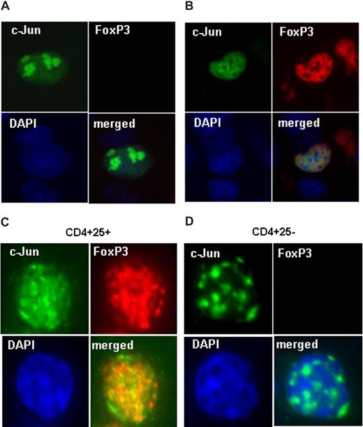 Figure 5. FoxP3 alters c-Jun subnuclear localization. (A,B) c-Jun-CFP expression plasmids were transfected without (A) or with (B) FoxP3 expression plasmids into HEK 293 cells. Transfected cells were immunostained with anti-FoxP3 antibody followed by a second antibody that has been labeled by Texas-Red. The nuclear DNA was stained with DAPI (blue). Cells were then visualized under the fluorescence microscopy. (C,D) CD4+ CD25+ cells and CD4+ CD25− cells were purified and stimulated with anti-CD3 and CD28 for 24 hours. Cells were cyto-spun onto slides, fixed with 4% paraformaldehyde, permeabilized with 0.1% Triton X-100, and immunostained with anti-FoxP3 (rat) and anti–c-Jun (rabbit), followed by anti–rat-Alexa 594 (red) and anti–rabbit-Alexa 488 (green). The nuclear DNA was stained with DAPI (blue). Cells were then visualized under the fluorescence microscopy and representative images were selected.