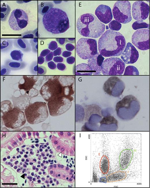 Figure 2. Morphology of adult zebrafish hematopoietic cells. (A-D) Peripheral blood smears showing: (A) bilobed neutrophil, (B) eosinophil, (C) lymphocyte and nucleated erythrocytes, and (D) aggregate of thrombocytes with visible cytoplasmic projections. (E-G) Kidney marrow cell cytospin showing: (E) progression of granulocyte maturation from immature (i,ii) to mature (iii) forms, (F) identification of granulocytes by myeloperoxidase cytochemistry, and (G) identification of granulocytes by Sudan black cytochemistry. (H) A cluster of hematopoietic cells (closed arrowhead) nestled between renal tubules (open arrowhead) (hematoxylin and eosin stained section). (I) FACS analysis of kidney marrow cells by forward scatter (FSC) and side scatter (SSC) separates erythroid (red), myelomonocytic (green), lymphocytic (blue), and progenitor (orange) cell populations. Bars represent 10μm (A-G) and 20μm (H). Microscopy was performed using a Nikon Optiphot-2 microscope equipped with a 40×/1.0 and 100×/1.40 oil objective. Images were obtained using a Zeiss Axiocam MRc5 digital camera (Carl Zeiss) with Axiovision AC software (Release 4.5). Images were processed using Adobe Photoshop CS2 9.0 and Adobe Illustrator CS2 12.0.1 (Adobe Systems).