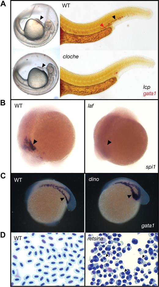 Figure 4. Zebrafish hematopoietic mutants. (A) cloche, a mutant in the earliest acting gene in hematopoiesis, upstream of the hemangioblast marker tal1(scl), shows a lack of circulating red hemoglobinized erythrocytes circulating over the yolk compared with wild-type (arrowheads) in brightfield images (left panels), and lacks expression of gata1 (red, erythrocytes) and lcp(l-plastin) (blue, myelomonocytes) in 2-color whole mount in situ hybridization (right panels). (B) The dorsalized alk8 mutant laf gl2 lacks anterior expression of the early myeloid marker spi1(pu.1). (C) The ventralized chordin mutant dino has expansion of the intermediate cell mass with increased expression of gata1 (blue). (D) Blood smears comparing wild-type and retsina (a scl4a1 (erythrocyte band 3) mutant) erythrocytes; retsina erythrocytes have distinctive binucleate erythroblasts (closed arrowhead), reminiscent of congenital dyserythropoietic anemia type II. (A-C) Gene expression by whole mount in situ hybridization. Microscopy was performed using a Nikon SMZ-1500 microscope (Nikon) equipped with a 0.75-11.25× objective (A-C). Images were obtained using a Zeiss Axiocam MRc5 digital camera (Carl Zeiss), with Axiovision AC software (Release 4.5). Images were processed using Adobe Photoshop CS2 9.0 and Adobe Illustrator CS2 12.0.1 (Adobe Systems).