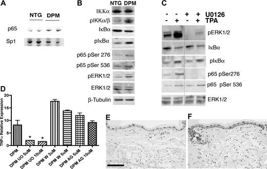 Figure 6. NFκB activation in K14-HIF-1αDPM keratinocytes is dependent on increased Erk1/2 phosphorylation. Increased nuclear translocation of the NFκB subunit p65 in transgenic (DPM) versus nontransgenic keratinocytes (NTG), normalized to Sp1 (A). Nuclear extracts were analyzed by Western blots. Western blot of lysates from newborn transgenic (DPM) keratinocytes indicate a 2- to 3-fold increase of phosphorylated IKKα, IκBα, p65 phosphorylation at serines 276 and 536, and phospho-ERK1/2, compared with nontransgenic (NTG) keratinocytes; β-tubulin is a loading control (B). Transgenic keratinocytes were pretreated with DMSO (−) or the MEK1/2 inhibitor U0126 (+) for 24 hours and analyzed at baseline (−) or 10 minutes after TPA treatment (+). Western blots of lysates from newborn transgenic keratinocytes show inhibition of phospho-ERK1/2 and p65 Ser276 phosphorylation by U0126 both at baseline and after TPA treatment (C). In contrast, phospho-IκBα, phospho-p65 Ser536, and the level of IκBα protein remain unaffected by ERK1/2 inhibition (C); total ERK1/2 is used as a loading control. The separating line in panel C represents one lane deleted from the same gel. Real-time RT-PCR analysis of TNFα expression from total RNA extracted from transgenic (DPM) primary keratinocytes shows selective inhibition of TNFα expression 24 hours after U0126 (U0) treatment in contrast to PI3 kinase pathway wortmannin (W), or EGFR AG1478 (AG) inhibition, both of which failed to alter transgenic keratinocyte TNFα expression (D). Bars represent mean plus or minus SEM. Results are representative of 3 independent experiments (*P < .05, t test). (E-F) Increased ERK1/2 phosphorylation is also evident in immunohistochemical analysis of transgenic compared with nontransgenic ears (E,F). Bar in panel E represents 100 μm.
