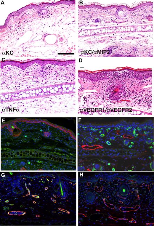 Figure 7. Immunodepletion of candidate chemokines, cytokines, and growth factors demonstrate selective dependence of HIF-1α–mediated inflammatory hyper-responsiveness on NFκB targets. Transgenic mice were pretreated with neutralizing antibodies targeting either KC (A), a KC/MIP-2 cocktail (B), TNFα (C), or a VEGFR1/VEGFR2 cocktail (D). Twenty-four hours later, a single dose of TPA (2.5 μg) was applied to the ear followed by tissue harvest 6 hours later and hematoxylin and eosin histostaining. Immunodepletion with either KC or TNFα antibodies markedly decreased, whereas the KC/MIP-2 cocktail abrogated, HIF-1α–mediated inflammatory hyper-responsiveness. In marked contrast, transgenic ears were resistant to VEGFR1/VEGFR2 immunodepletion. Immunofluorescence for GR1 expression confirms that KC/MIP-2 depletion abrogates neutrophil recruitment to TPA-challenged transgenic ears (E, GR1, green; K14, red). In contrast, immunodepleted, TPA-challenged transgenic ears retain elevated subepidermal microvascular density and lymphatic dilatation (F, MECA32, green; LYVE-1, red). Decreased immunofluorescence for ICAM1 on TPA-challenged transgenic ears pretreated with VEGFR1/2 neutralizing antibodies (H, ICAM-1, green; MECA32, red) versus nonpretreated and TPA-challenged transgenic ears (G, ICAM-1, green; MECA32, red) confirms the effectiveness of VEGFR1/2 antibody treatment. Bar in panel A represents 100 μm.
