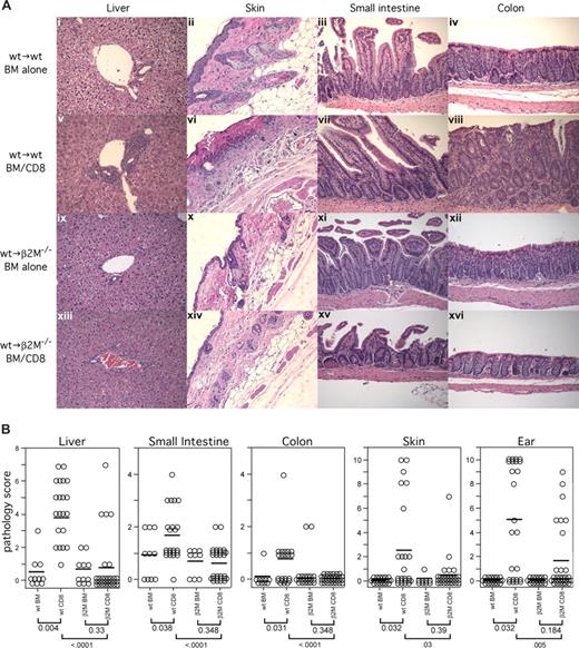 Figure 4. Only wt→wt and not wt→β2M−/− chimeric recipients of C3H.SW CD8 cells develop histologic GVHD. (A) Representative histology (original magnification ×200). (B) Combined histology scores from 2 independent experiments. Each symbol is the score from an individual mouse; horizontal lines represent mean scores. P values are shown below the group labels.
