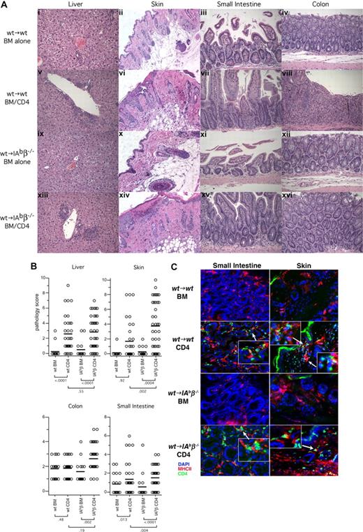 Figure 6. Both wt→wt and wt→IAbβ−/− CD4 recipients develop histologic GVHD. (A) Representative histology (original magnification ×200). (B) Combined histology scores from 3 independent experiments. Each symbol is the score from an individual mouse; horizontal lines represent mean scores. P values are shown below the group labels. (C) Immunofluorescent staining of small intestine and skin from both wt→wt and wt→IAbβ−/− recipients of 129 CD4+ T cells. Blue indicates DAPI-stained nuclei; green, CD4+ cells; red, MHCII+ cells. Note infiltrating CD4+ cells in both bowel and skin of CD4 recipients, frequently adjacent to MHCII+ cells.