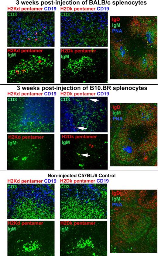 Figure 1. Allospecific B cells can be detected in situ in allosensitized murine spleen using pentamers. Colors for the different markers are indicated in colored text. Magnification is 400× (left and middle panels) and 200× (right panels).
