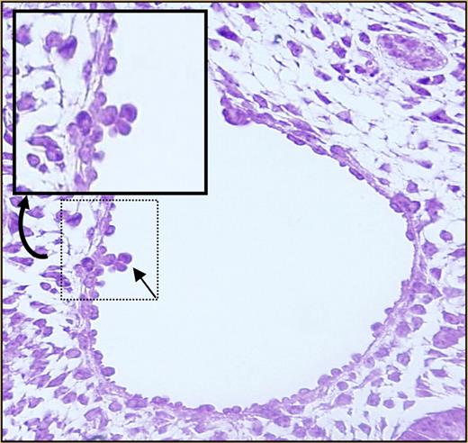 Definitive hematopoiesis of embryos at day E10.5. See the complete figure in the article beginning on page 3313.