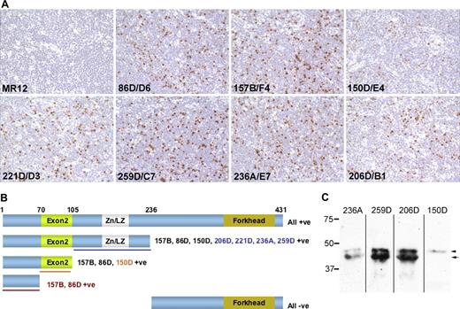 Figure 1. Comparative reactivity of “in house” hybridoma supernatants containing our FOXP3 monoclonal antibodies. Panel A illustrates immunoperoxidase labeling of the same area from sequentially cut sections from a single, paraffin-fixed and formalin-embedded tonsil, using previously described methodology.4 Tonsil tissue was collected with informed patient consent under ethical approval from the Oxfordshire Clinical Research Ethics Committee in accordance with the Declaration of Helsinki. Cells were counterstained with hematoxylin Gill No. 2 (Sigma-Aldrich, St Louis, MO), mounted in Aquatex (VWR International, Poole, United Kingdom) and viewed using a 40×/0.65 numerical aperture objective (Zeiss) on a bright field Axioskop microscope (Zeiss, Welwyn Garden City, United Kingdom). Images were captured using a Micropublisher 5MP RTV camera (QImaging, Surrey, BC). In terms of both frequency and intensity of FOXP3+ cell labeling, antibody 259D/C7 was as effective as the other clones. Panel B illustrates the full-length and truncated recombinant FOXP3 proteins that were expressed in COS-1 cells and their reactivity with the panel of FOXP3 antibodies by immunoperoxidase labeling. The expression of each truncated FOXP3 protein was also verified by detection of the Xpress epitope tag. The clone names in colored fonts indicate those antibodies with an epitope in the region of FOXP3 indicated by underlining in the same color. Numbers above the full-length protein give amino acid coordinates for FOXP3 truncations. Panel C shows Western blotting detection of FOXP3 expression in a lysate prepared from CD4+CD25+ peripheral blood mononuclear cells that were purified using a Regulatory T-Cell Isolation Kit (Miltenyi Biotech, Bisley, United Kingdom) from a blood buffy coat preparation obtained from the National Blood Service (Bristol, United Kingdom). Antibodies 259D/C7 and 206D/B1 strongly labeled both FOXP3 isoforms, while weaker labeling was observed with 236A/E7. As predicted, the smaller FOXP3 isoform lacking exon 2 was not detected by 150D/A3.
