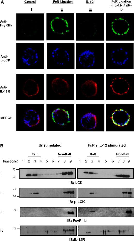 Figure 1. Both FcγRIIIa and IL-12R localize to lipid raft domains on NK cells in response to FcR activation in the presence of IL-12. (A) Purified human NK cells were activated via FcγRIIIa ligation in the presence of huIL-12 for 5 minutes at 37°C (column iv). Control conditions consisted of untreated NK cells (column i), NK cells activated via FcR ligation alone (column ii), or NK cells activated with IL-12 alone (column iii). The green channel shows the location of FcγRIIIa and the red channel shows the distribution of IL-12R, while the blue channels represents p-Lck (a component of lipid raft microdomains11). Single confocal sections of the cells were captured in multitrack. Each set of frames in a given column is a representative individual NK cell selected from 1 of 20 analyzed cells. Superimposed white-yellow patches signify areas of colocalization of FcγRIIIa IL-12R and p-Lck. (B) Detergent-insoluble cholesterol-enriched lipid rafts were prepared by Brij-98 extraction of purified human NK cells that were left unstimulated (left column) or activated via FcγRIIIa ligation in the presence of IL-12 for 5 minutes (right column) and separated on a sucrose density gradient. A total of 9 sequential fractions collected from the gradient were subjected to immunoblot analysis for p-Lck, FcγRIIIa, and IL-12R. Fractions 2, 3, and 4 correspond to detergent-insoluble lipid fractions; fractions 7, 8, and 9 correspond to detergent-soluble fractions. All results shown are representative of 3 independent experiments.