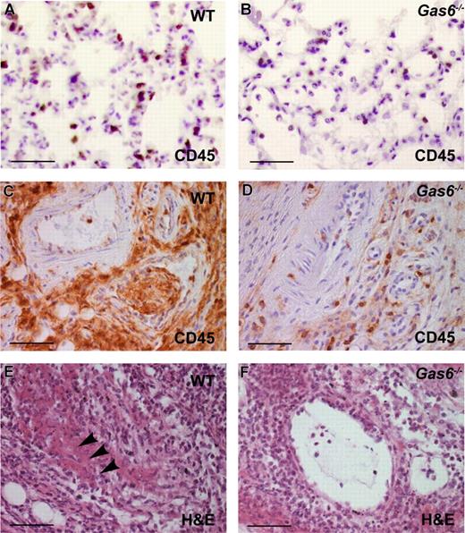 Figure 3. In vivo role of Gas6 in inflammation and thrombosis. (A,B) CD45 staining in lungs of WT and Gas6−/− mice 4 hours after intraperitoneal injection of 20 mg/kg LPS showed higher neutrophil extravasation in the lung parenchyme of WT mice (A) compared with Gas6−/− animals (B). (C-D) CD45 immunostaining in footpads of WT and Gas6−/− animals, injected with 50 μg LPS, revealed extensive inflammation in the adventitial and muscle area of WT animals (E), whereas vessels in Gas6−/− animals were less inflamed (D). (E,F) Hematoxylin and eosin staining in footpads of WT and Gas6−/− animals, injected with 50 μg LPS, revealed the presence of large, organized thrombi covering most of the lumen in veins of WT animals (E), whereas vessels in Gas6−/− animals contained fewer and smaller thrombi (F). Magnification bar represents 50 μm in all panels.