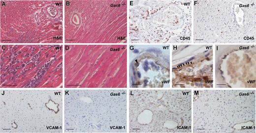 Figure 4. Role of Gas6 in graft destruction of mouse heart grafts exposed to warm ischemia. (A-F) Hematoxylin and eosin (A,D) and CD45 (E,F) stainings of sections through WT and Gas6−/− mouse heart grafts, 10 days after transplantation, revealed profound inflammatory cell infiltration and myocardial cell necrosis (A,C,E) in the WT heart graft. In contrast, the Gas6−/− transplanted heart graft showed a remarkably normal morphology and only limited leukocyte infiltration (B,D,F). (G-I) Immunostaining for VWF (brown) combined with nuclear counterstaining with Harris hematoxylin (blue) revealed platelets (arrowhead in panel H), leukocytes, and platelet-leukocyte conjugates (arrowhead in panel G) adhering to the wall of the coronary vessels in the graft of WT mice, whereas this was not seen in hearts transplanted in Gas6−/− mice (I). VCAM-1 (J,K) and ICAM-1 (L,M) up-regulated expression is reduced in Gas6−/− hearts transplanted into Gas6−/− mice (K,M) compared with WT cardiac grafts, dissected 3 days after transplantation into WT mice (J,L). Bar represents 100 μm in panels A and B, 50 μm in panels C-F and J-M, and 10 μm in panels G-I.