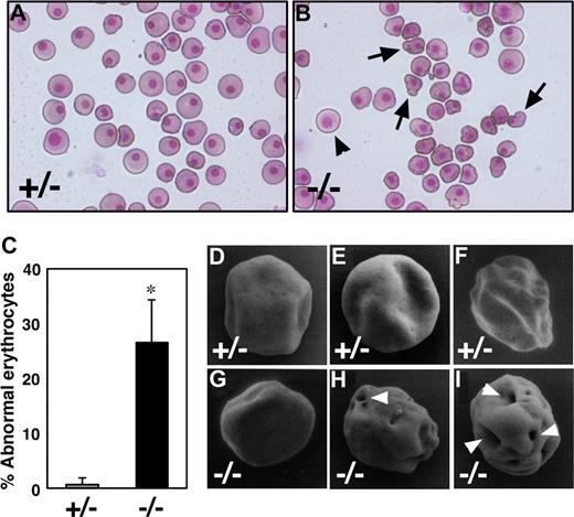Figure 1. Runx1−/− primitive erythrocytes show defect in morphology. (A,B) May-Grunwald Giemsa stained cytospin preparation of peripheral blood cells at E12.5. Although normal erythrocytes () can be seen in Runx1−/− embryo, 27% of them show apparent deformed shape (). (C) Quantification of abnormal primitive erythrocytes in Runx1+/− (n = 3) and Runx1−/− (n = 4) embryos at E12.5. *Significance (P = .002, Student t test). (D-I) Scanning electron microscopy of primitive erythrocytes at E12.5. Shown are representative pictures of primitive erythrocytes from Runx1+/− (n = 3) and Runx1−/− (n = 3) embryos. Characteristic large holes (white arrowheads) were observed in Runx1−/− erythrocytes (9 of 20), not in Runx1+/− erythrocytes (0 of 16). This difference is statistically significant (P = .002 by Fisher exact probability test). Original magnifications: A,B, ×400; D-G, ×8000; H, ×8500; I, ×9000. A Leica (Wetzlar, Germany) DC500 CCD camera with IM50 Imaging Manager through Leica DMRXA microscope was used to capture the images using a 20×/0.50 NA objective (A,B).