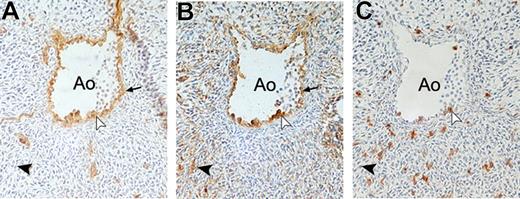 Figure 6. Expression of BB9 in the AGM region of the developing human embryo. Cross sections through the dorsal aorta (Ao) in a 34-day human embryo immunostained with CD34 (A), BB9 (B), and CD45 (C). BB9 stains hematopoietic CD34+CD45+ cell clusters associated with the endothelium on the ventral site of the aorta (white arrowheads), as well as the CD34+ endothelial cells (). BB9 also recognizes some cells in the mesoderm underneath the aorta (). No colocalization of CD34 or CD45 antigens is observed in these BB9-positive cells (➤). Sections were observed with a Nikon Eclipse 50i light microscope with 20× magnification (20×/0.50 objective) and figures were acquired by a Nikon Digital Sight DS-2Mv camera (Nikon, Tokyo, Japan). Images were processed using Photoshop 7.0 software (Adobe Systems, San Jose, CA).